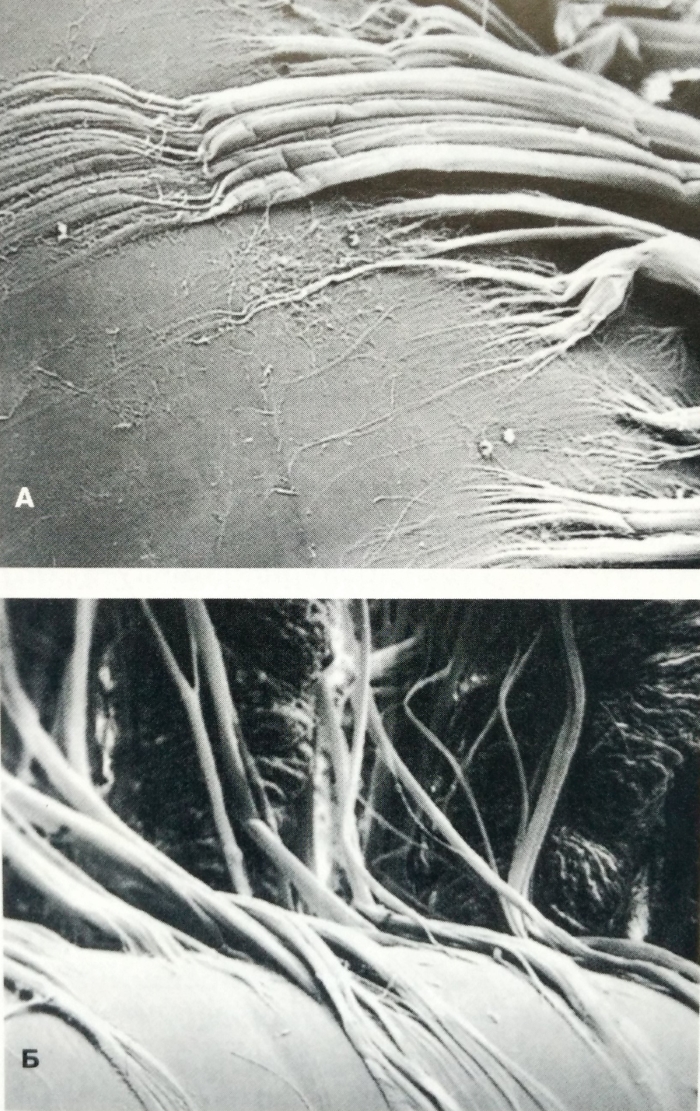 Особенности прикрепления ресничного пояска к передней части поверхности капсулы хрусталика (А) и области экватора (Б)