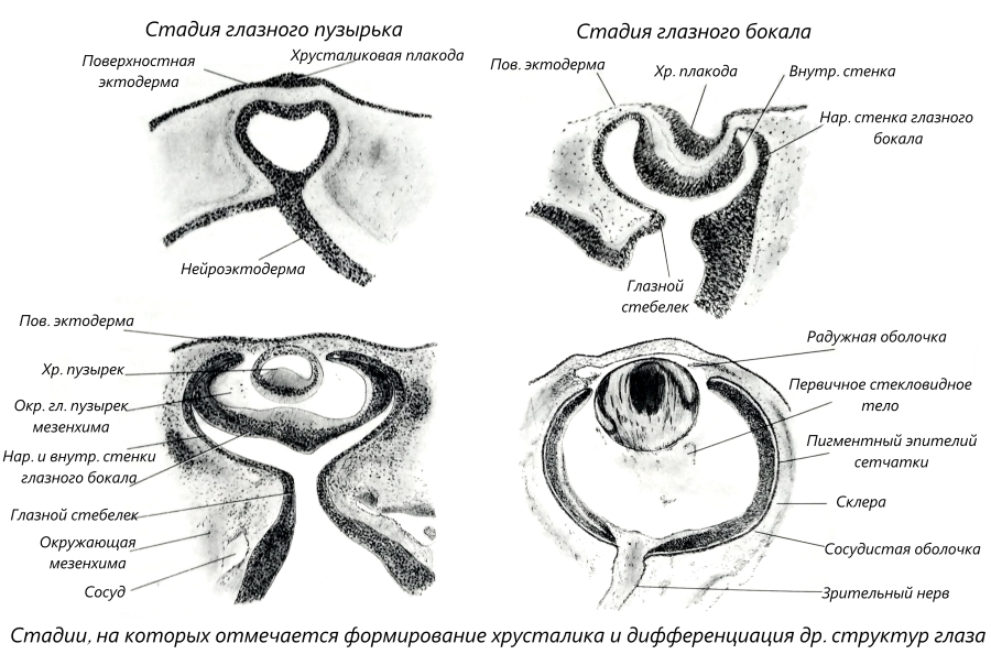 Микроскопическая картина последовательных стадий развития глазного бокала