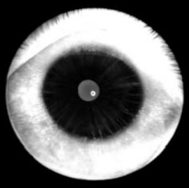 ФАГ радужки левого глаза (30 с)