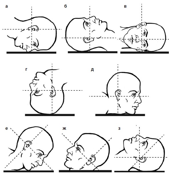 Основные обзорные проекции черепа