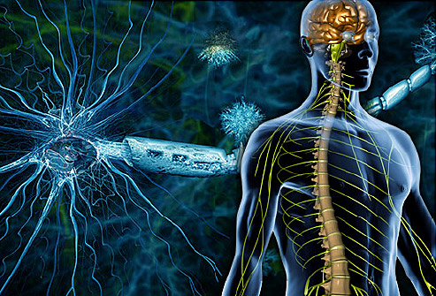 Демиелинизация нервных волокон при рассеянном склерозе