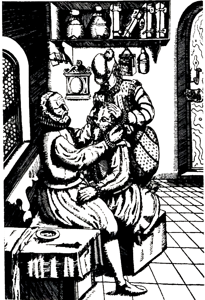 Выполнение операции удаления катаракты по George Bartisch, 1583